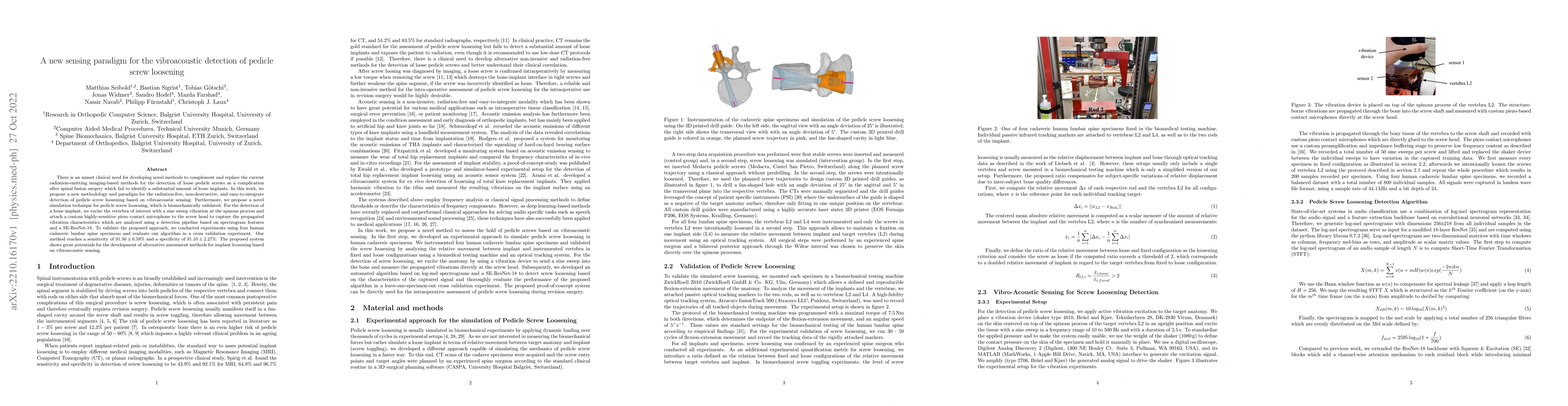 Thumbnail for A new sensing paradigm for the vibroacoustic detection of pedicle screw
  loosening