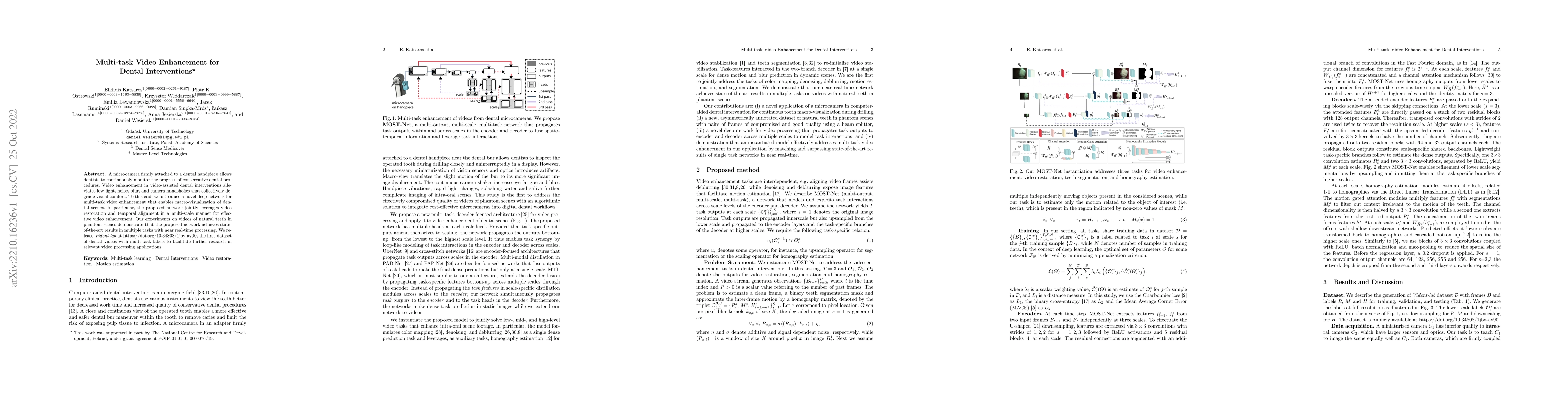 Thumbnail for Multi-task Video Enhancement for Dental Interventions