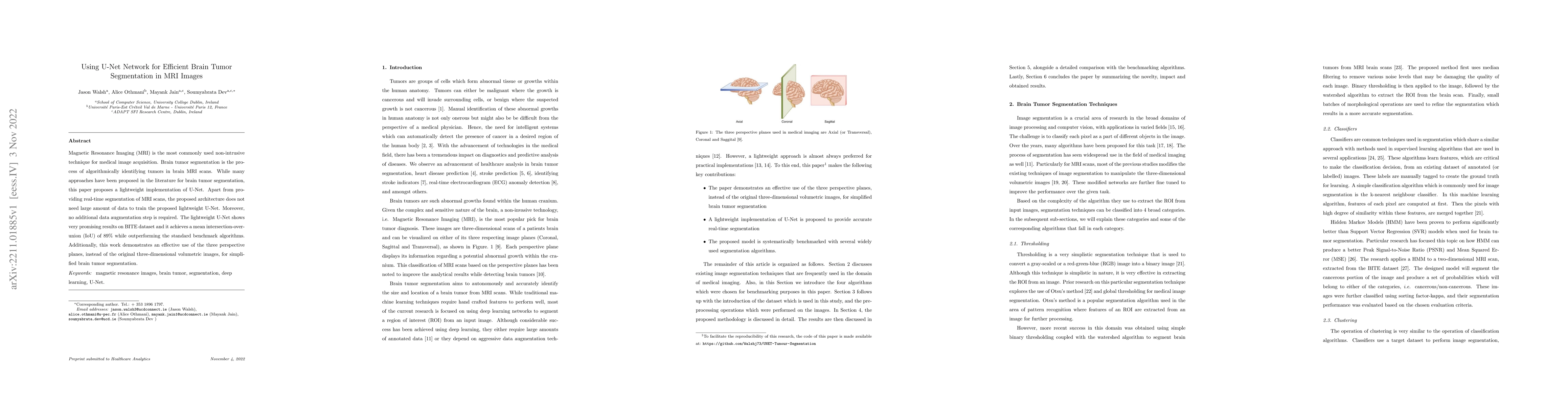 Thumbnail for Using U-Net Network for Efficient Brain Tumor Segmentation in MRI Images