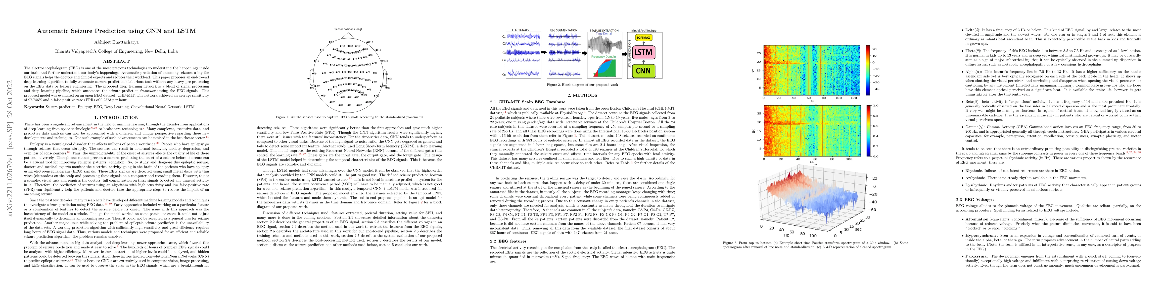 Thumbnail for Automatic Seizure Prediction using CNN and LSTM