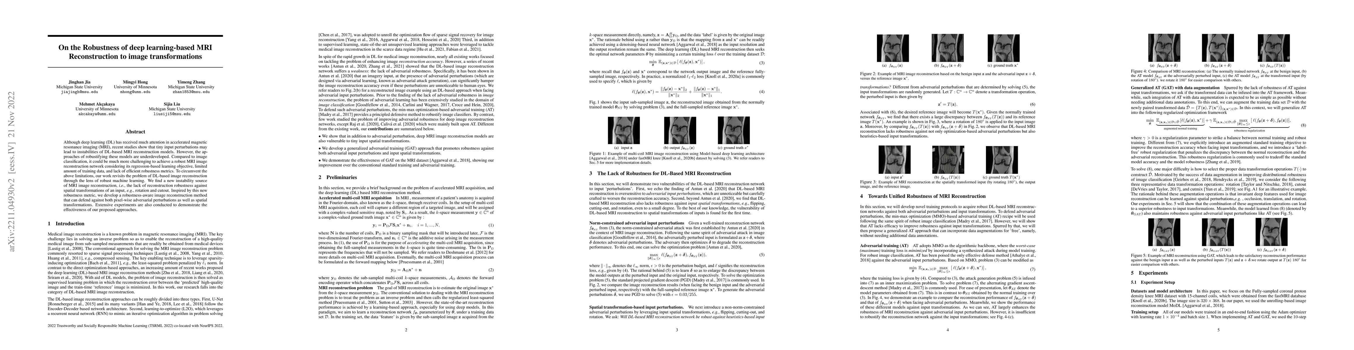 Thumbnail for On the Robustness of deep learning-based MRI Reconstruction to image
  transformations