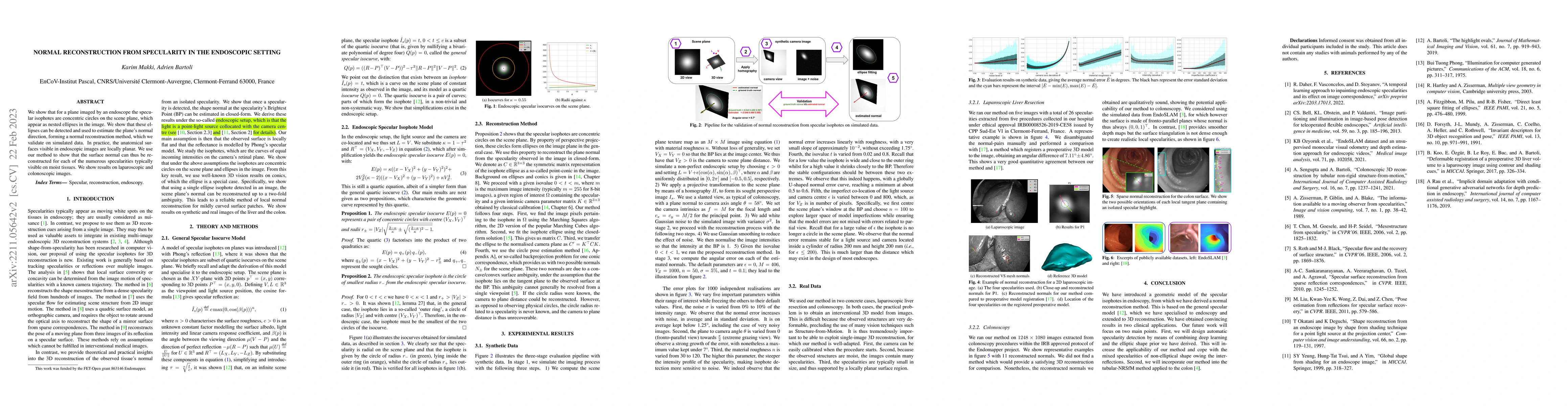Thumbnail for Normal reconstruction from specularity in the endoscopic setting