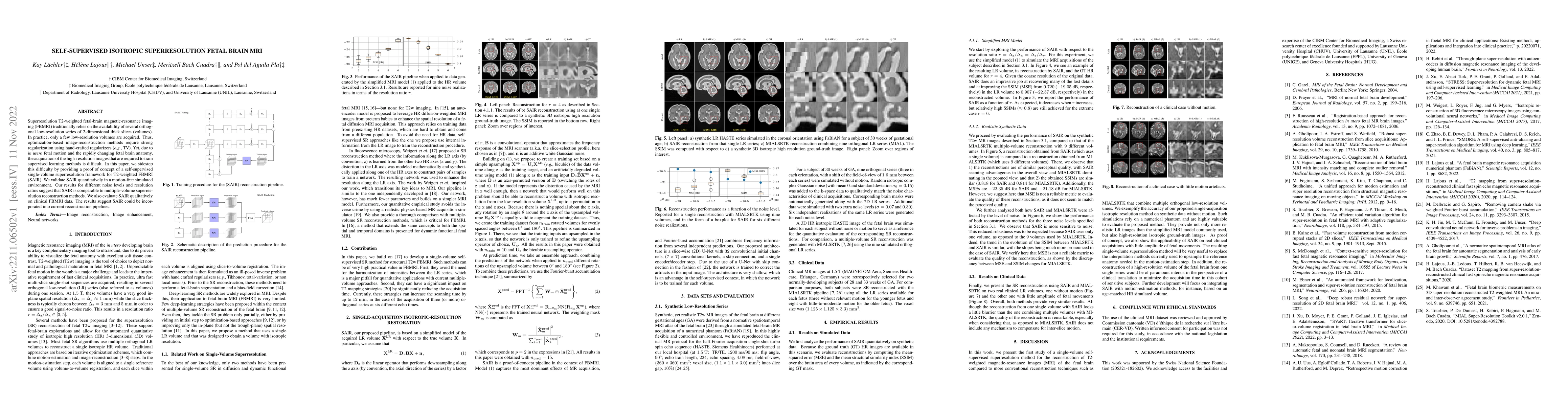 Thumbnail for Self-Supervised Isotropic Superresolution Fetal Brain MRI
