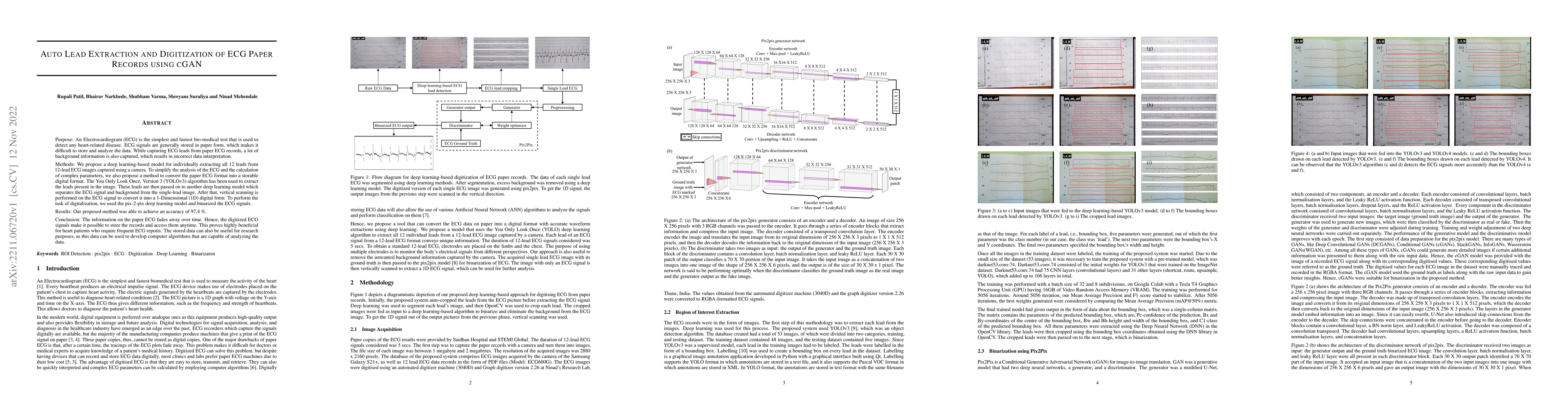 Thumbnail for Auto Lead Extraction and Digitization of ECG Paper Records using cGAN