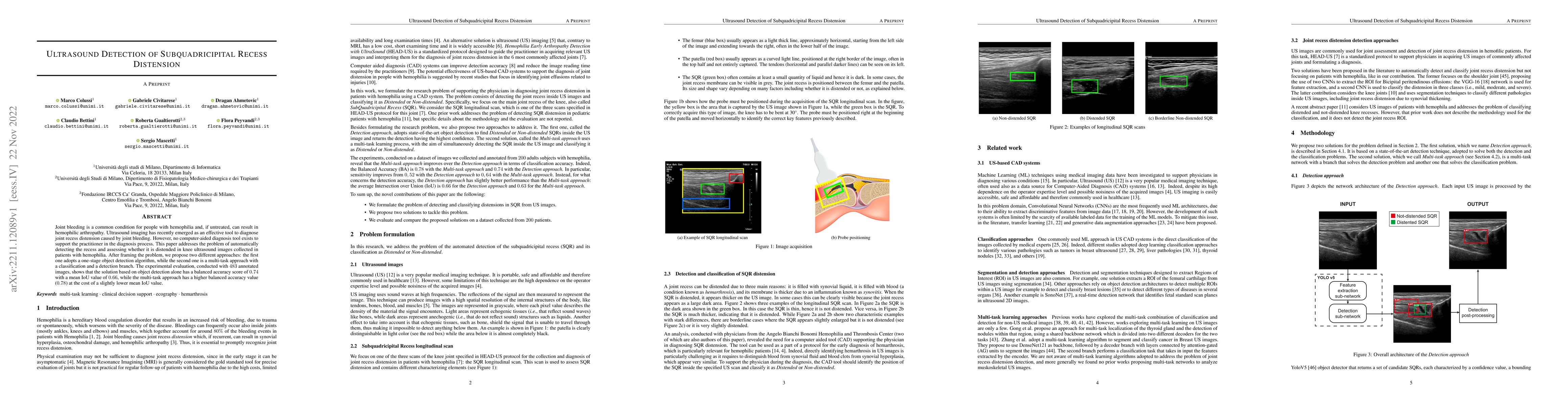 Thumbnail for Ultrasound Detection of Subquadricipital Recess Distension