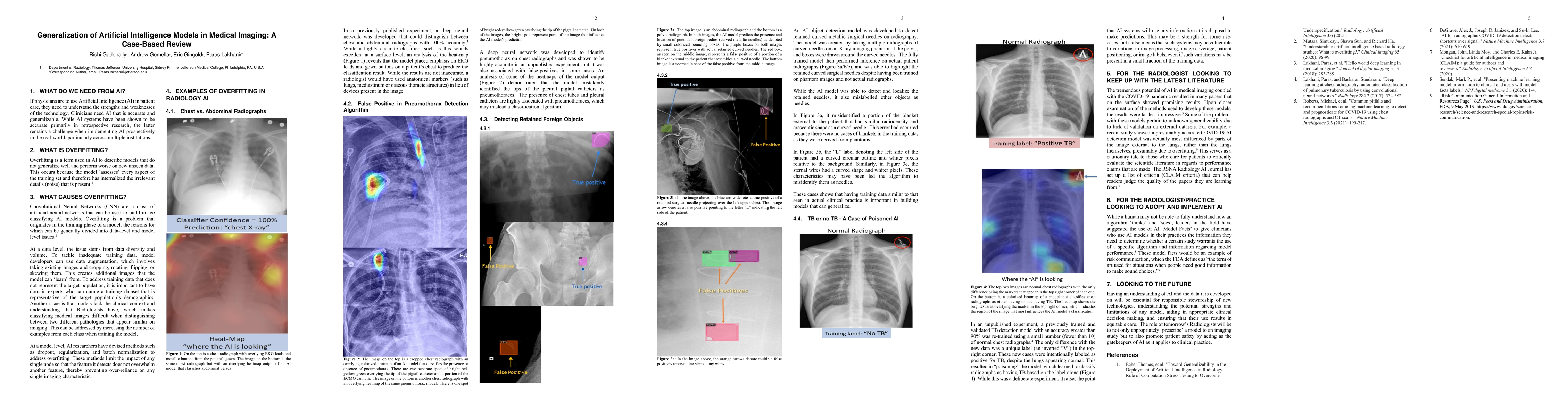 Thumbnail for Generalization of Artificial Intelligence Models in Medical Imaging: A
  Case-Based Review