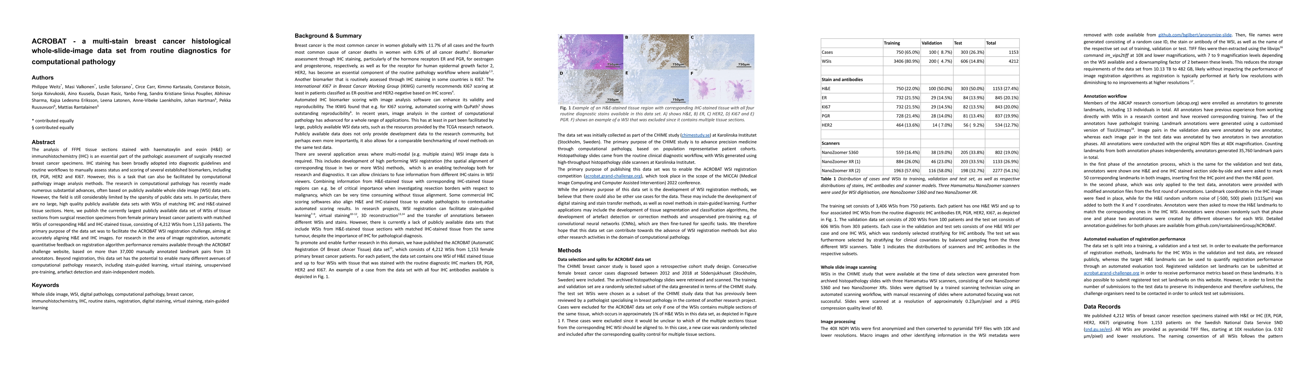 Thumbnail for ACROBAT -- a multi-stain breast cancer histological whole-slide-image
  data set from routine diagnostics for computational pathology