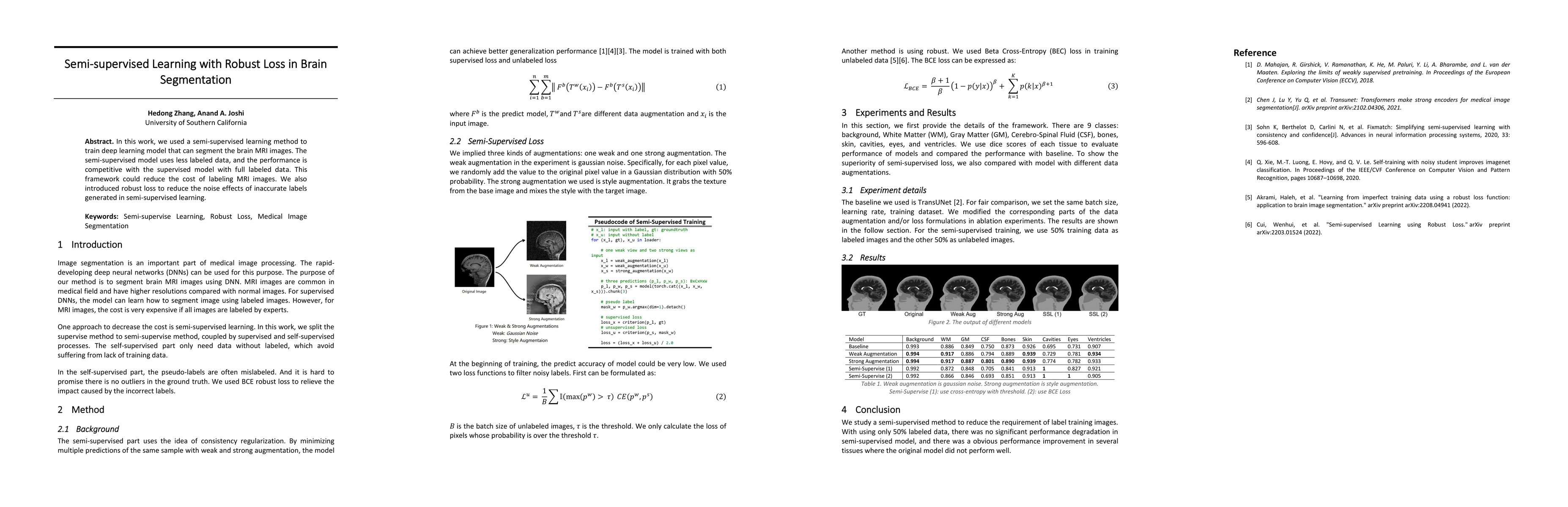 Thumbnail for Semi-supervised Learning with Robust Loss in Brain Segmentation