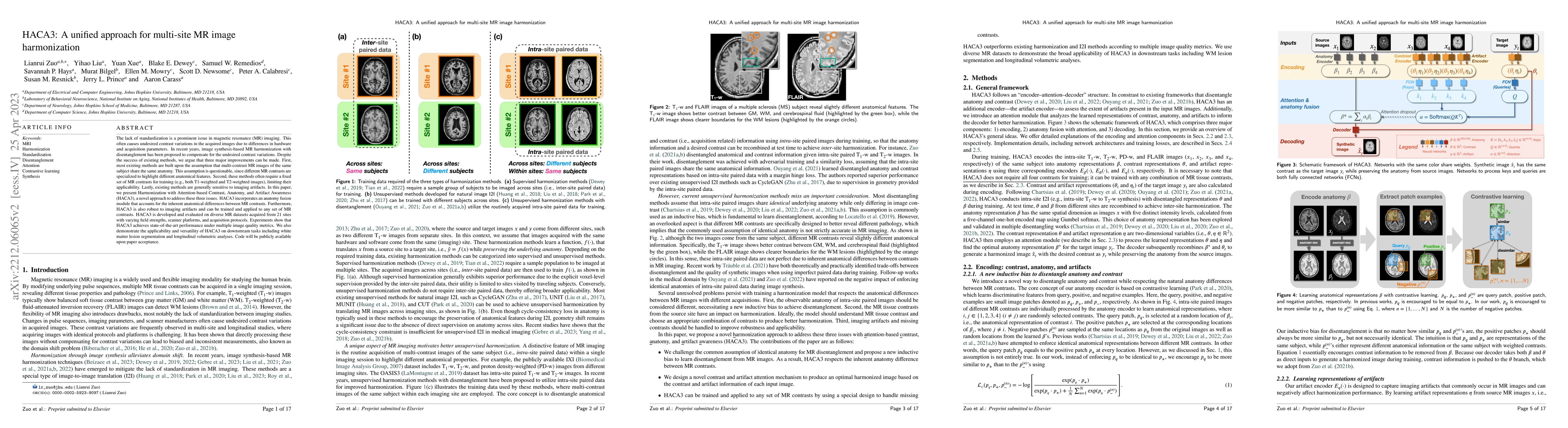Thumbnail for HACA3: A Unified Approach for Multi-site MR Image Harmonization