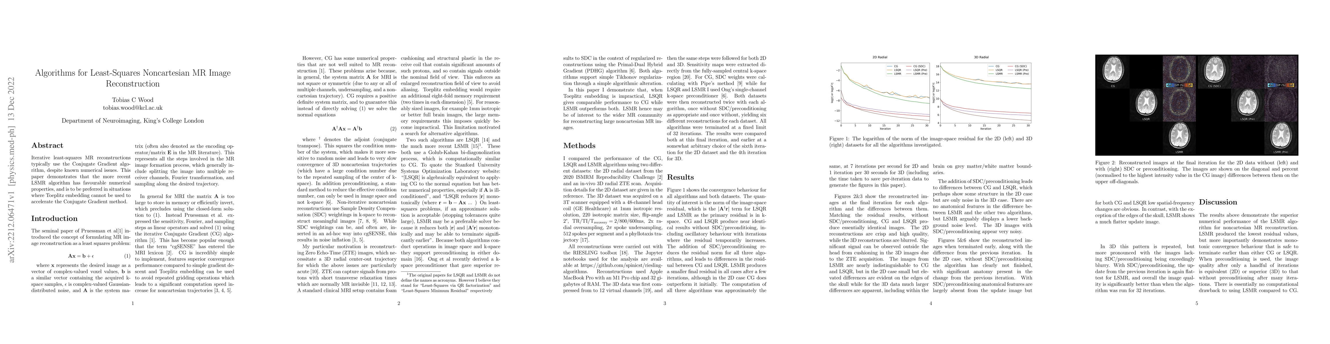 Thumbnail for Algorithms for Least-Squares Noncartesian MR Image Reconstruction