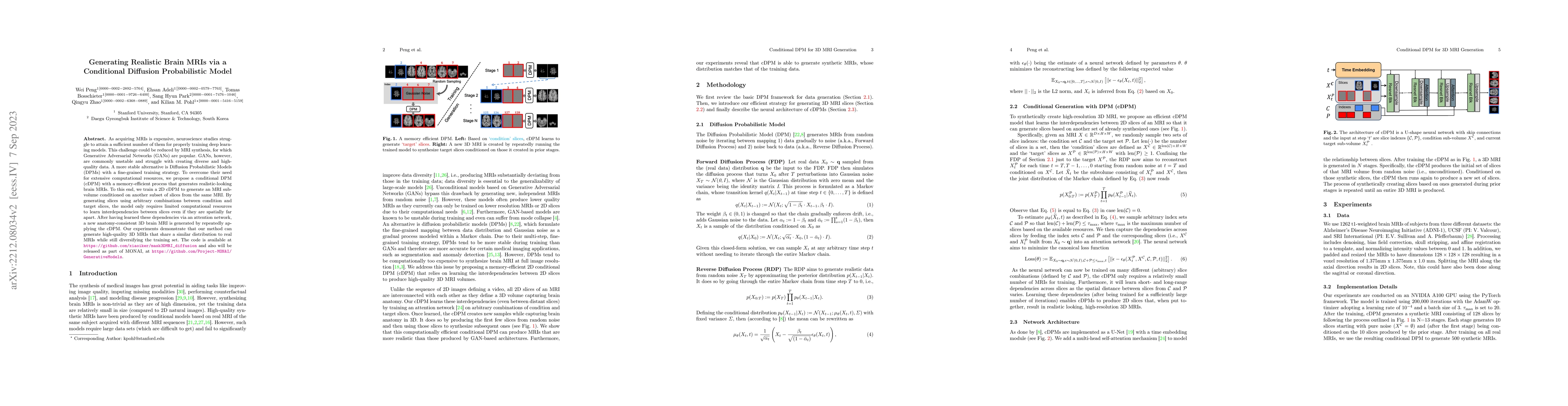 Thumbnail for Generating Realistic Brain MRIs via a Conditional Diffusion
  Probabilistic Model