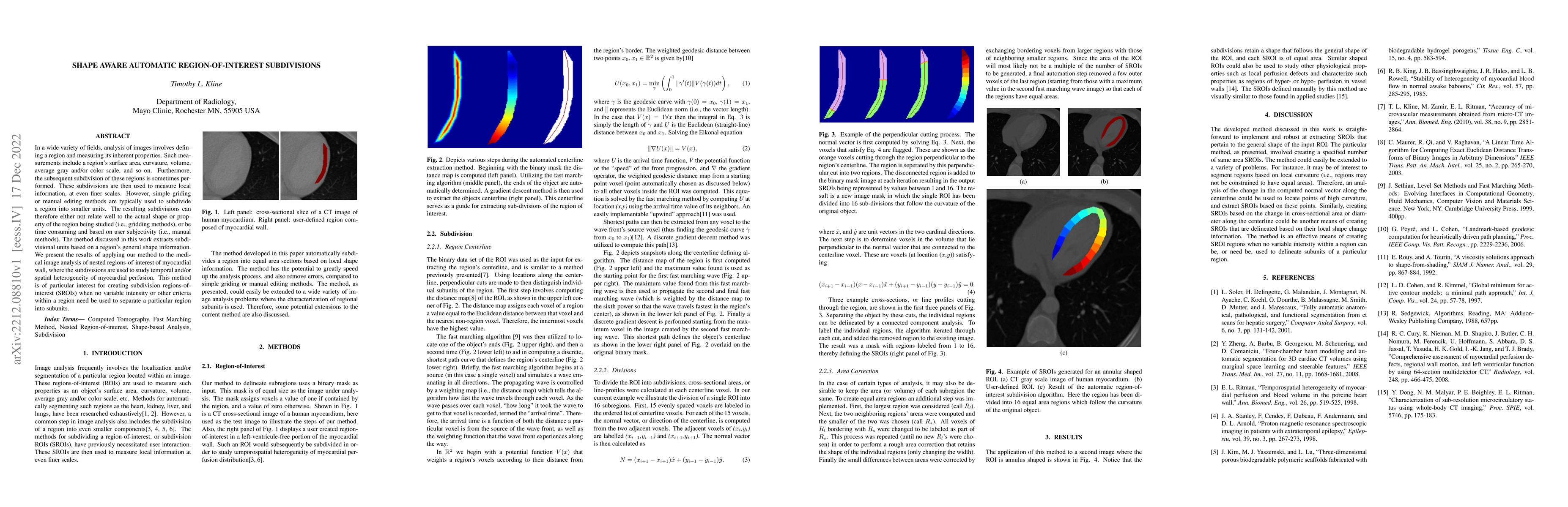 Thumbnail for Shape Aware Automatic Region-of-Interest Subdivisions