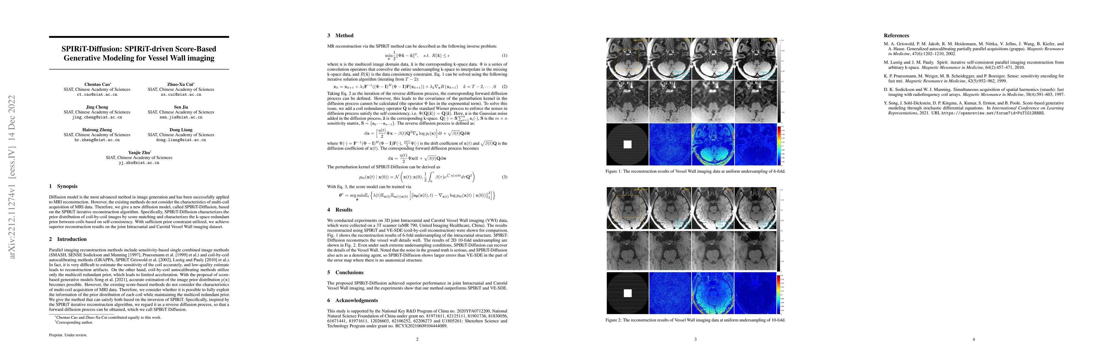 Thumbnail for SPIRiT-Diffusion: SPIRiT-driven Score-Based Generative Modeling for
  Vessel Wall imaging