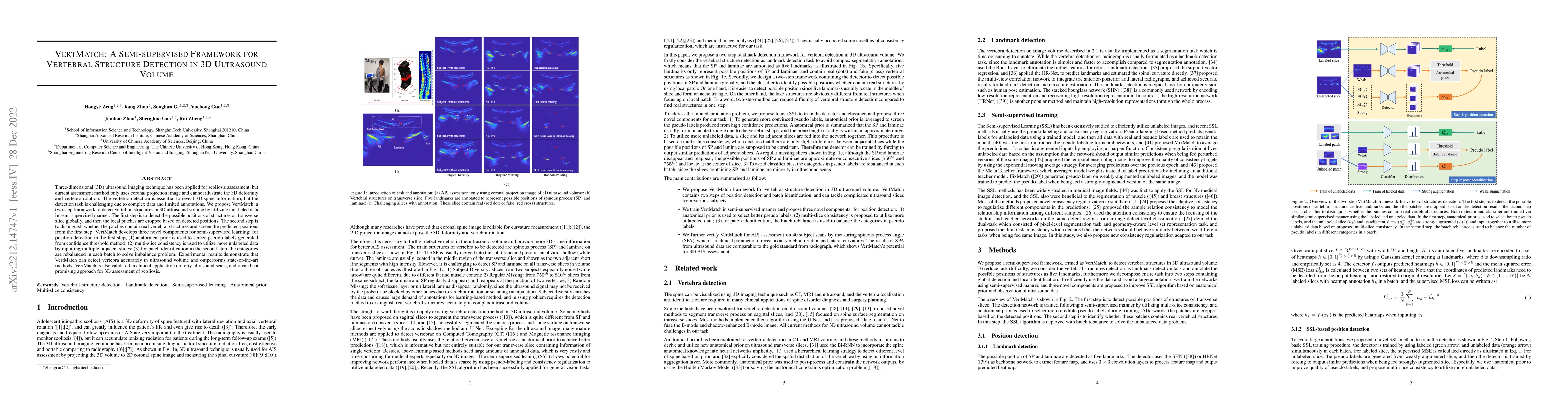 Thumbnail for VertMatch: A Semi-supervised Framework for Vertebral Structure Detection
  in 3D Ultrasound Volume
