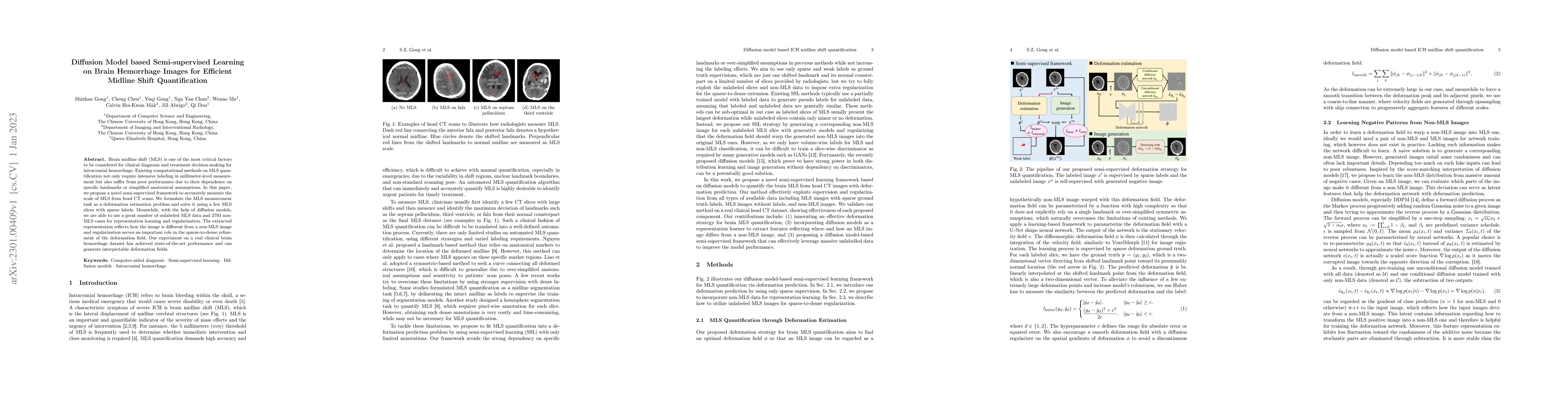Thumbnail for Diffusion Model based Semi-supervised Learning on Brain Hemorrhage
  Images for Efficient Midline Shift Quantification