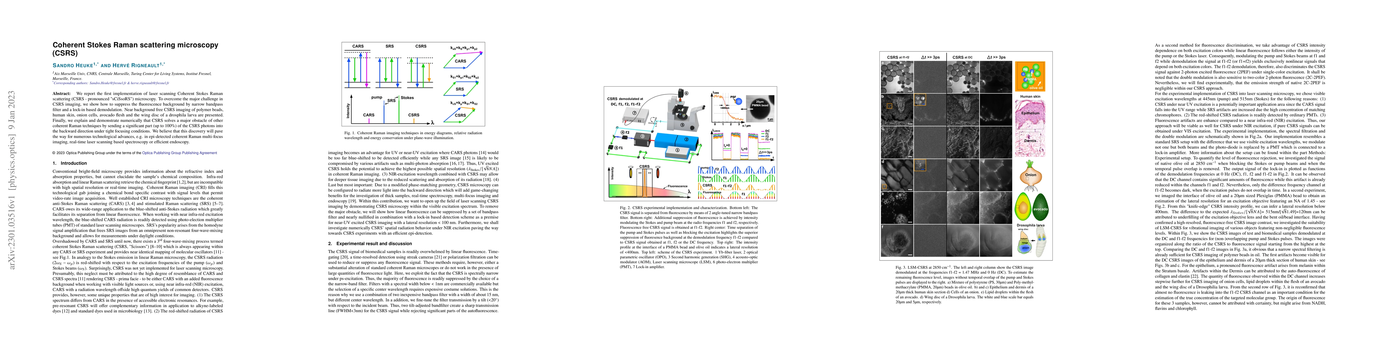 Thumbnail for Coherent Stokes Raman scattering microscopy (CSRS)