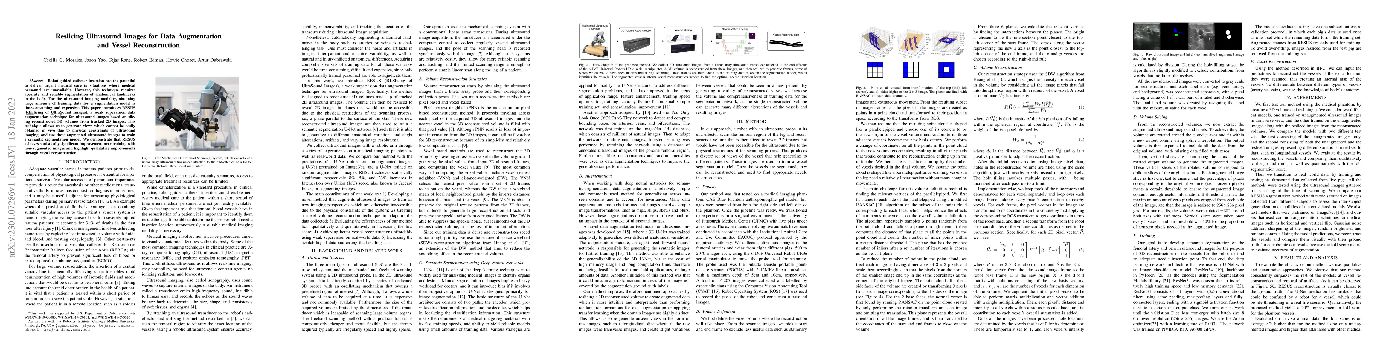 Thumbnail for Reslicing Ultrasound Images for Data Augmentation and Vessel
  Reconstruction