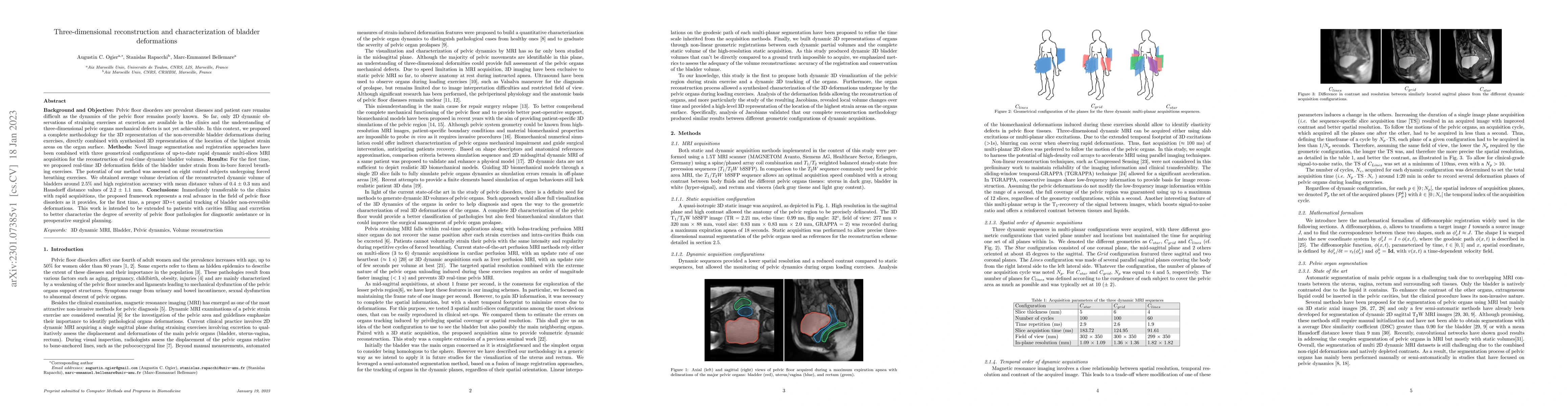 Thumbnail for Three-dimensional reconstruction and characterization of bladder
  deformations