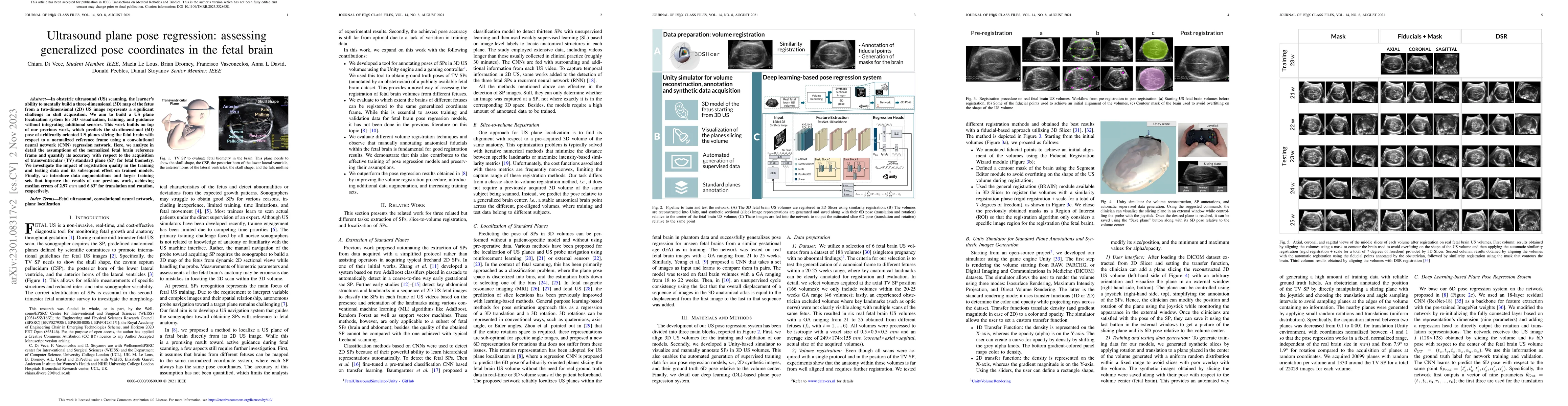 Thumbnail for Ultrasound Plane Pose Regression: Assessing Generalized Pose Coordinates
  in the Fetal Brain