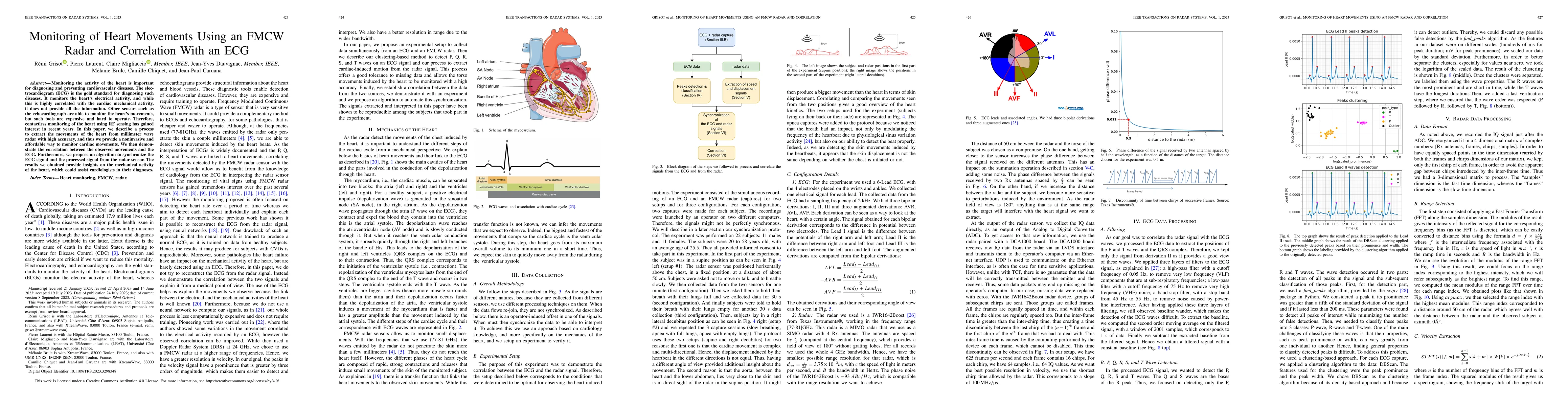 Thumbnail for Monitoring of the heart movements using a FMCW radar and correlation
  with an ECG