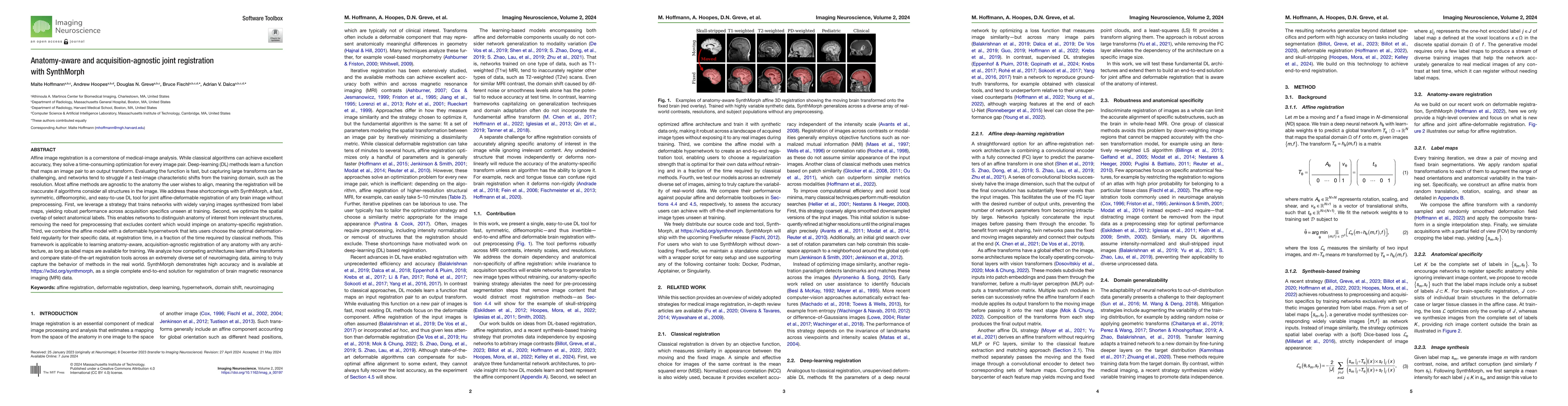 Thumbnail for Anatomy-aware and acquisition-agnostic joint registration with
  SynthMorph