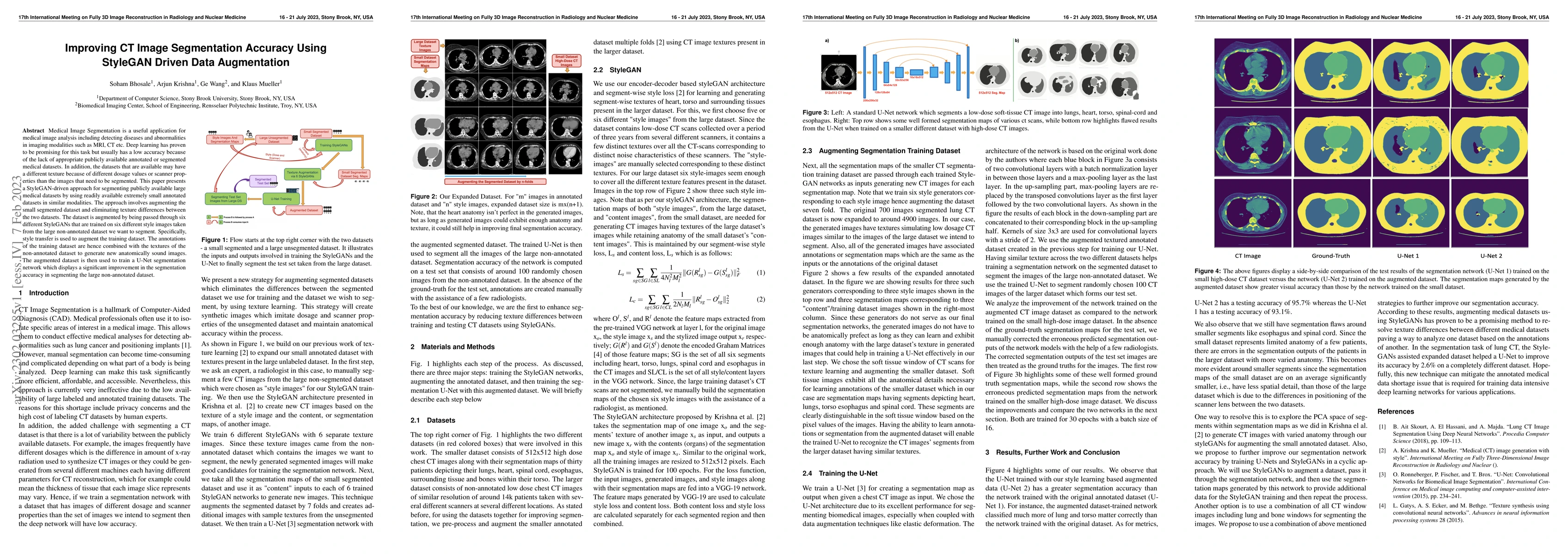 Thumbnail for Improving CT Image Segmentation Accuracy Using StyleGAN Driven Data
  Augmentation
