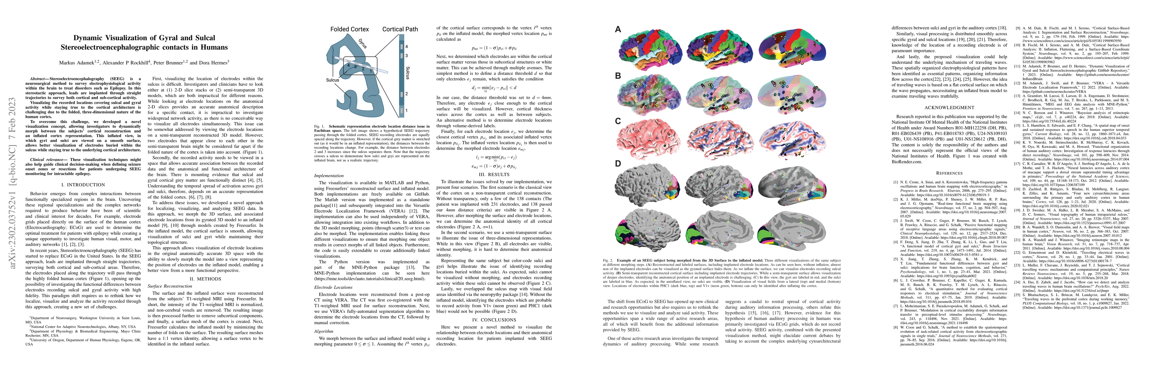 Thumbnail for Dynamic Visualization of Gyral and Sulcal Stereoelectroencephalographic
  contacts in Humans