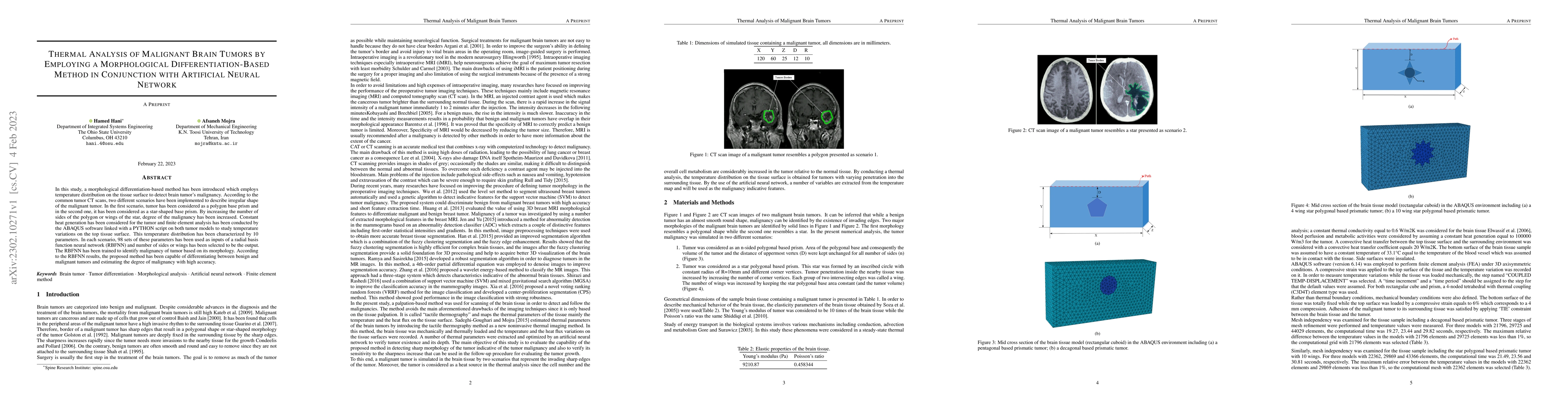 Thumbnail for Thermal Analysis of Malignant Brain Tumors by Employing a Morphological
  Differentiation-Based Method in Conjunction with Artificial Neural Network