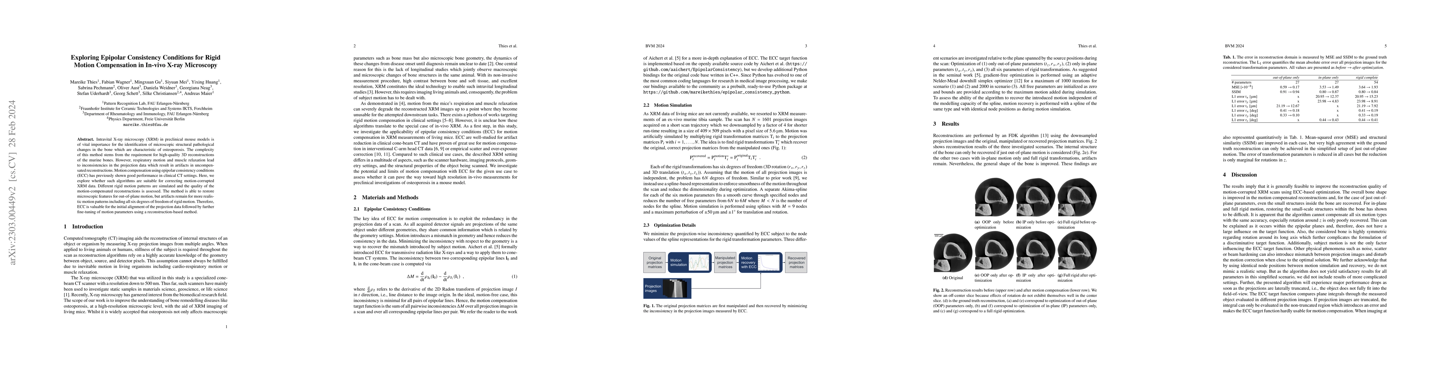 Thumbnail for Exploring Epipolar Consistency Conditions for Rigid Motion Compensation
  in In-vivo X-ray Microscopy