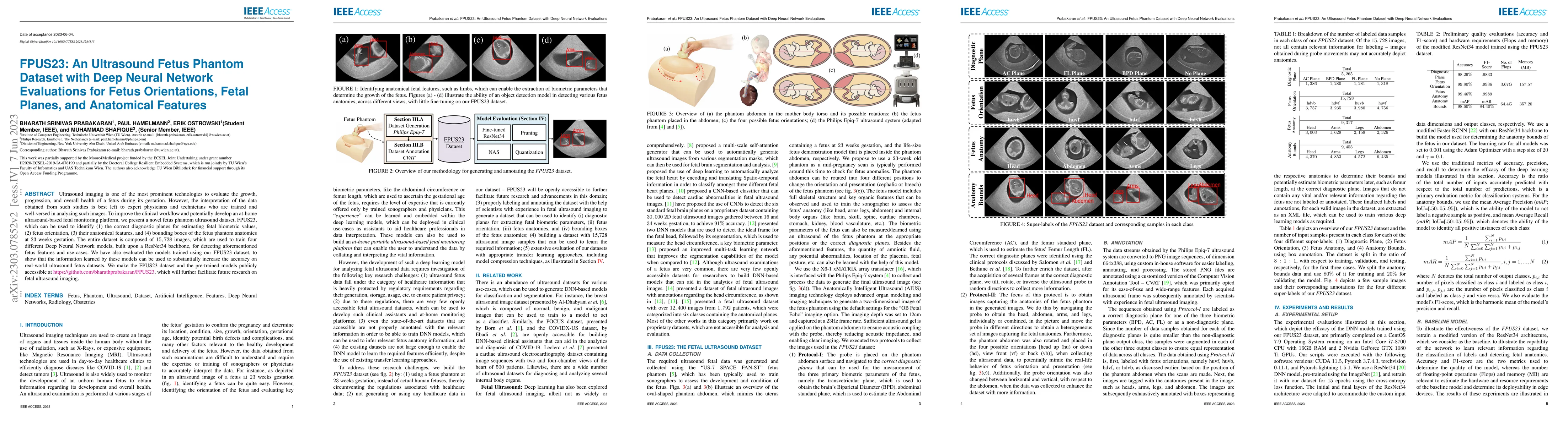 Thumbnail for FPUS23: An Ultrasound Fetus Phantom Dataset with Deep Neural Network
  Evaluations for Fetus Orientations, Fetal Planes, and Anatomical Features