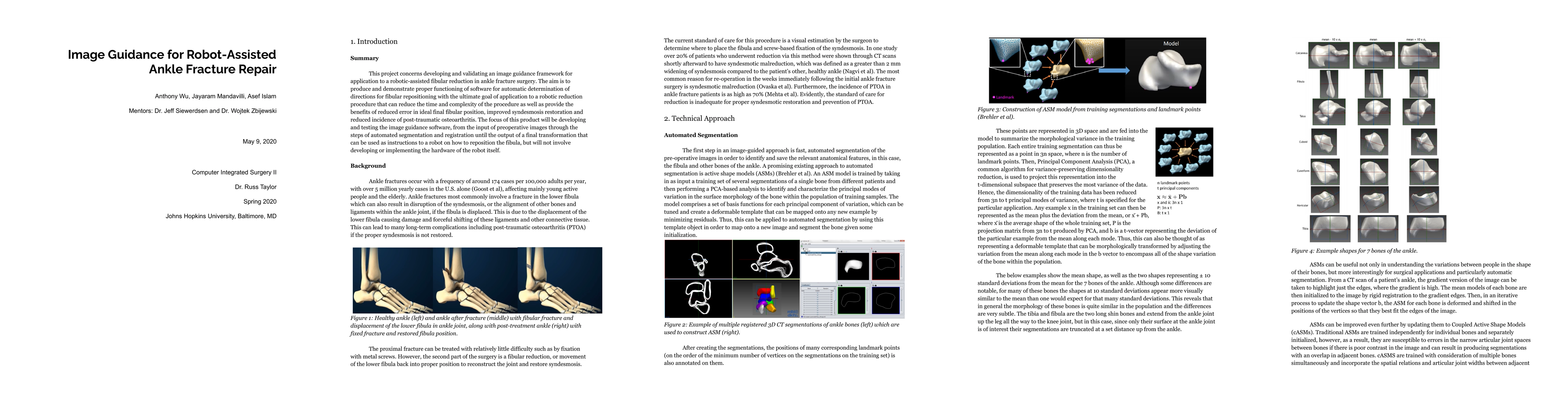 Thumbnail for Image Guidance for Robot-Assisted Ankle Fracture Repair