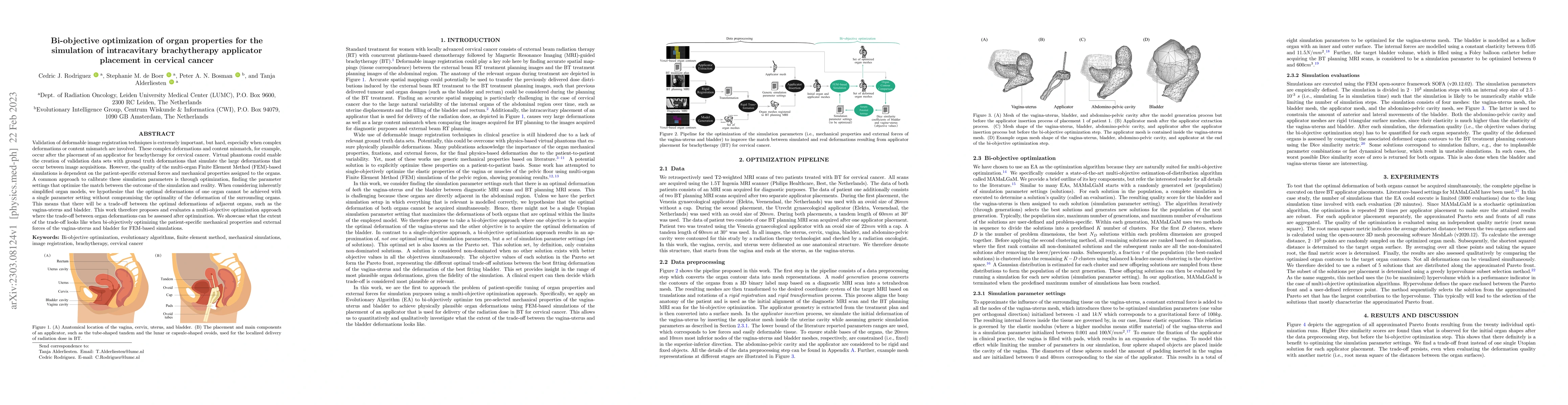 Thumbnail for Bi-objective optimization of organ properties for the simulation of
  intracavitary brachytherapy applicator placement in cervical cancer