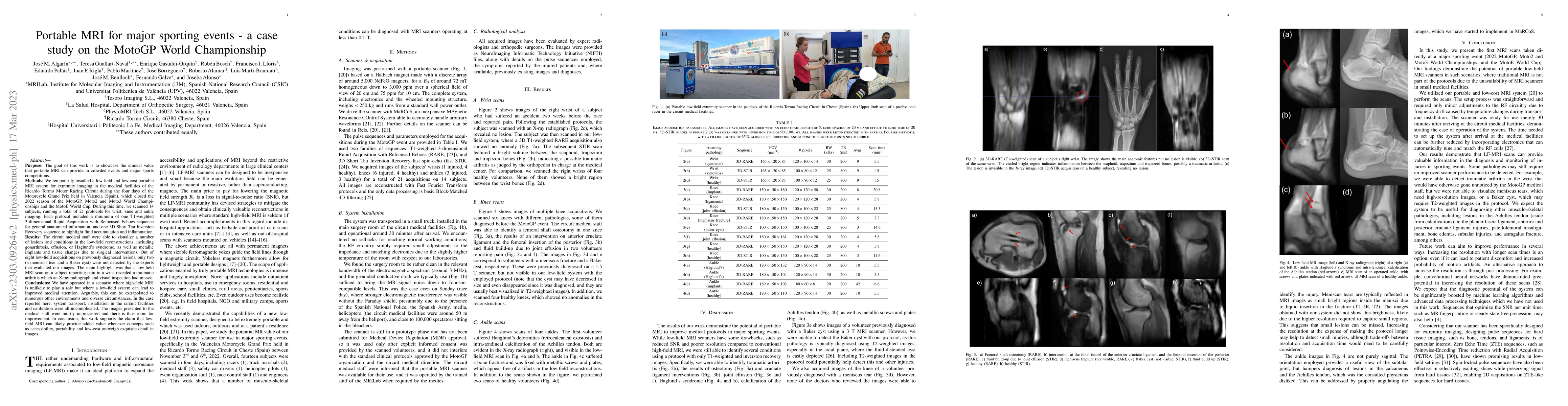 Thumbnail for Portable MRI for major sporting events -- a case study on the MotoGP
  World Championship