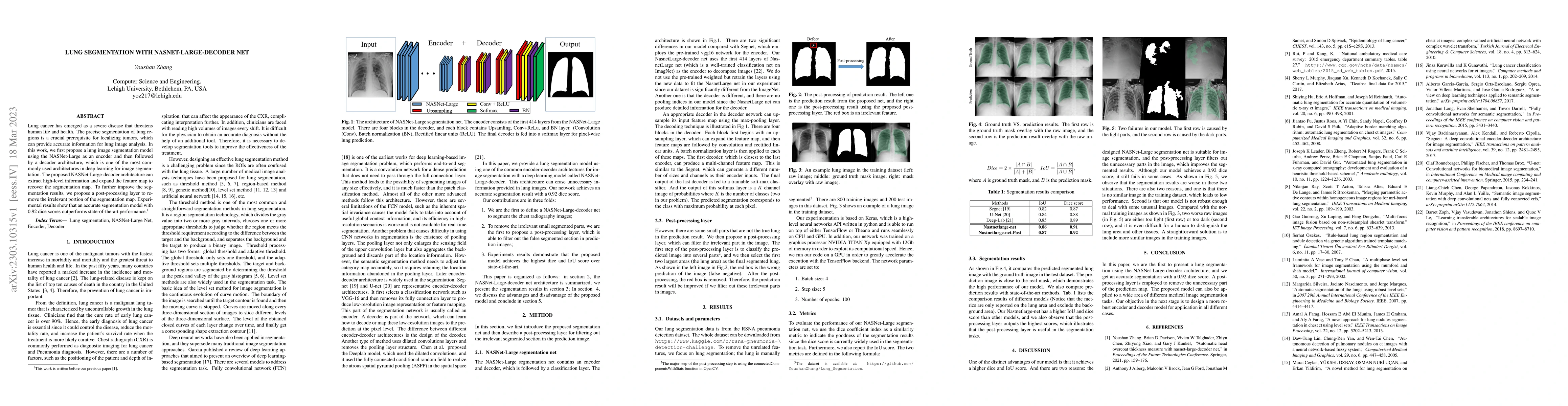 Thumbnail for Lung segmentation with NASNet-Large-Decoder Net