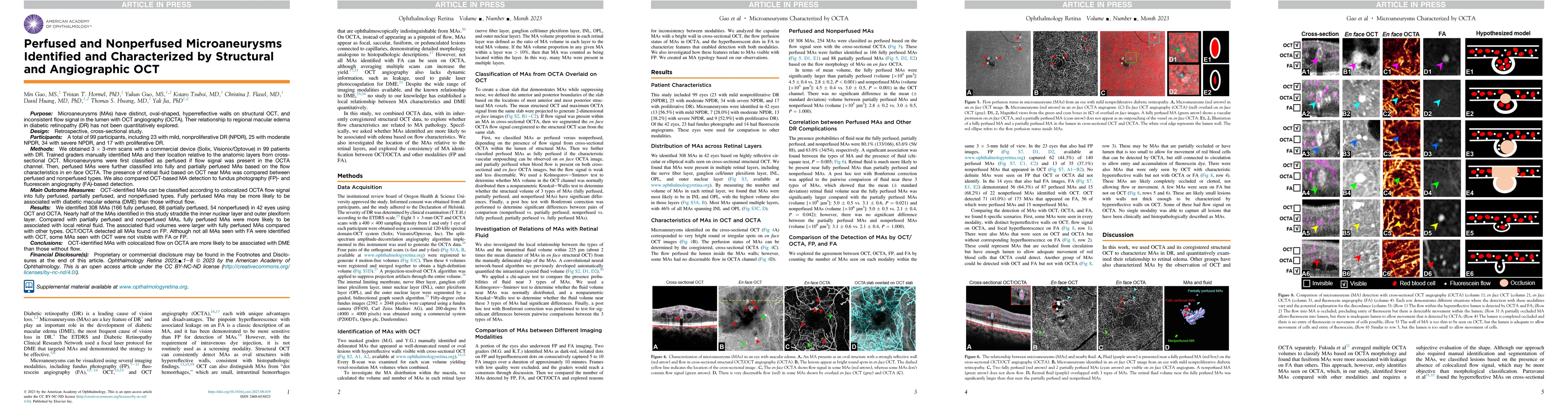 Thumbnail for Perfused and Nonperfused Microaneurysms Identified and Characterized by
  Structural and Angiographic OCT