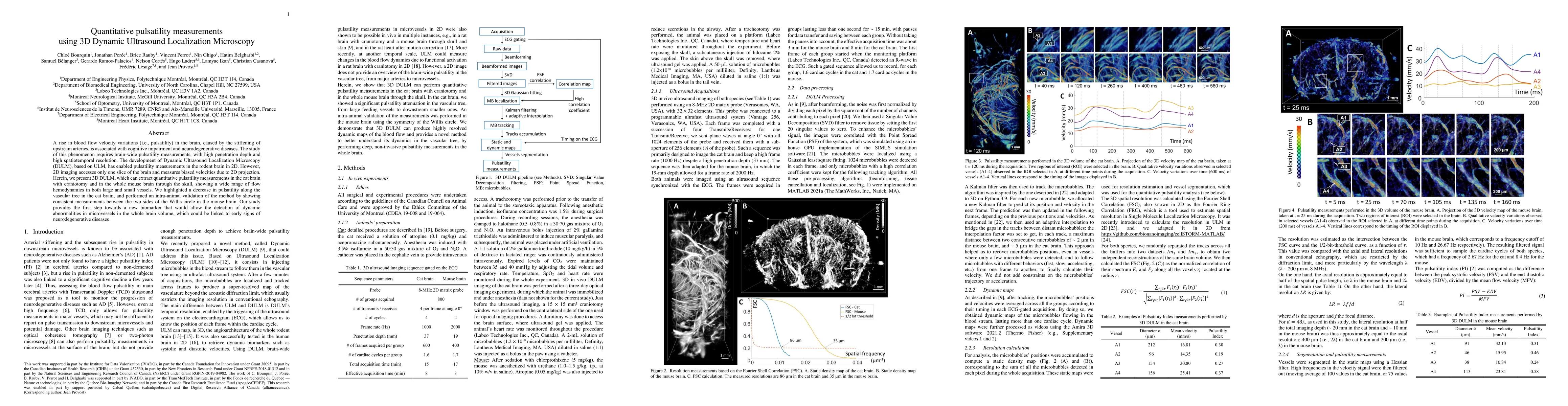 Thumbnail for Quantitative pulsatility measurements using 3D Dynamic Ultrasound
  Localization Microscopy