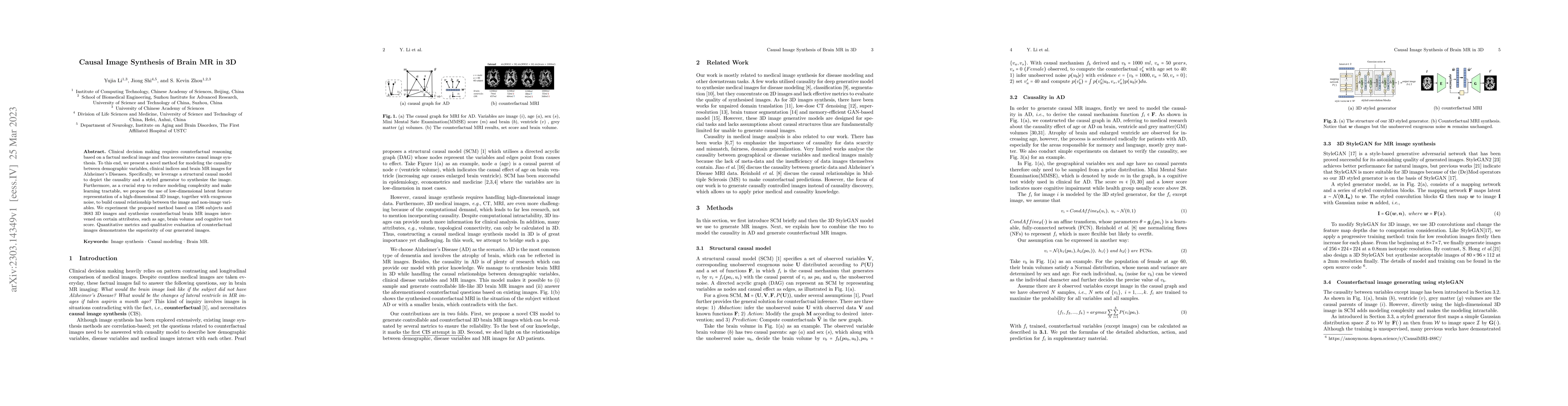 Thumbnail for Causal Image Synthesis of Brain MR in 3D