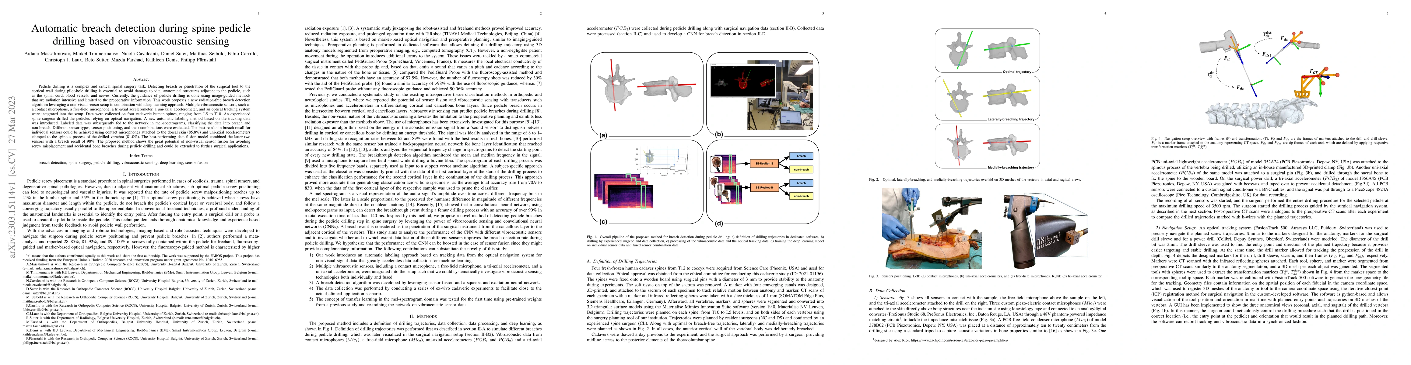 Thumbnail for Automatic breach detection during spine pedicle drilling based on
  vibroacoustic sensing