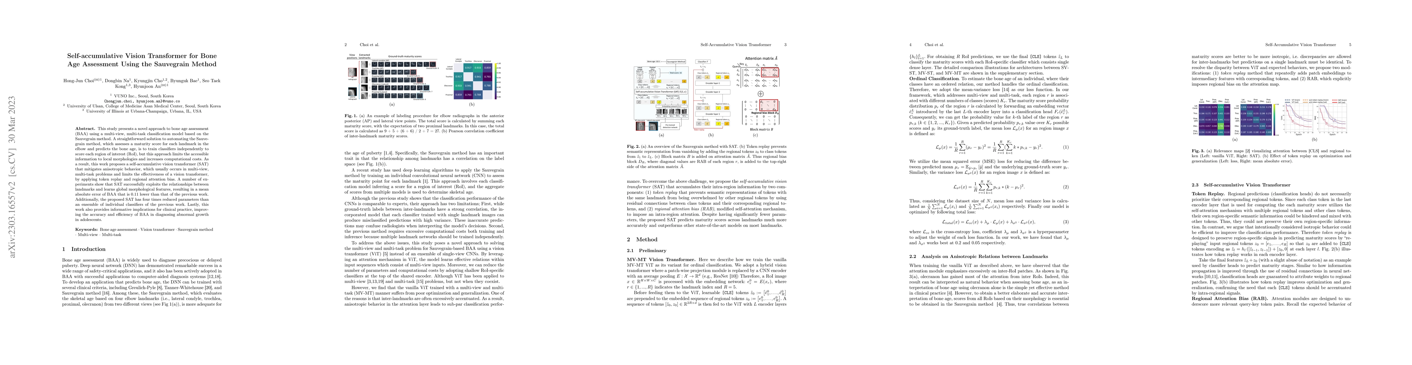 Thumbnail for Self-accumulative Vision Transformer for Bone Age Assessment Using the
  Sauvegrain Method