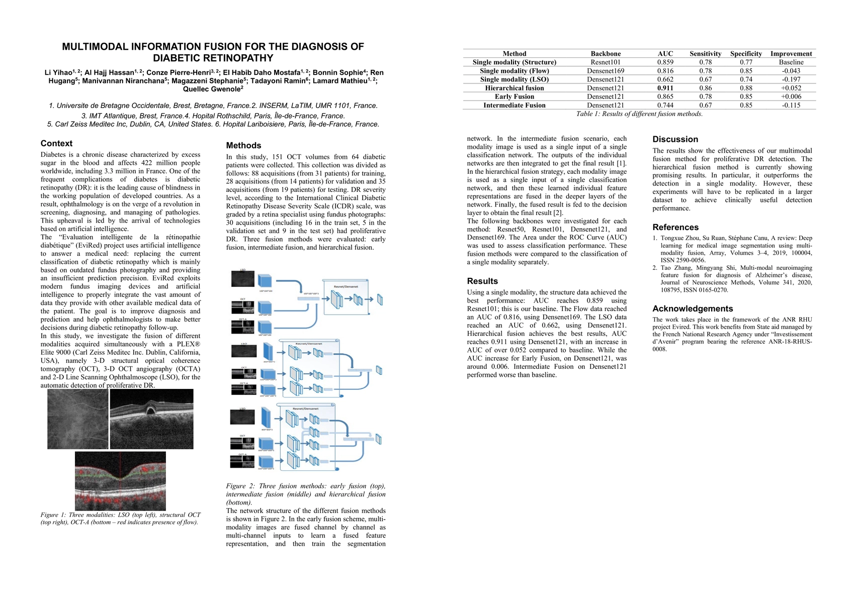 Thumbnail for Multimodal Information Fusion For The Diagnosis Of Diabetic Retinopathy