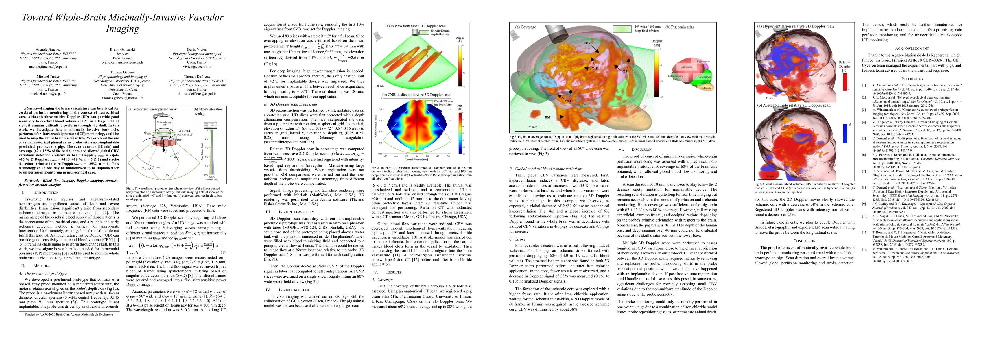 Thumbnail for Toward Whole-Brain Minimally-Invasive Vascular Imaging