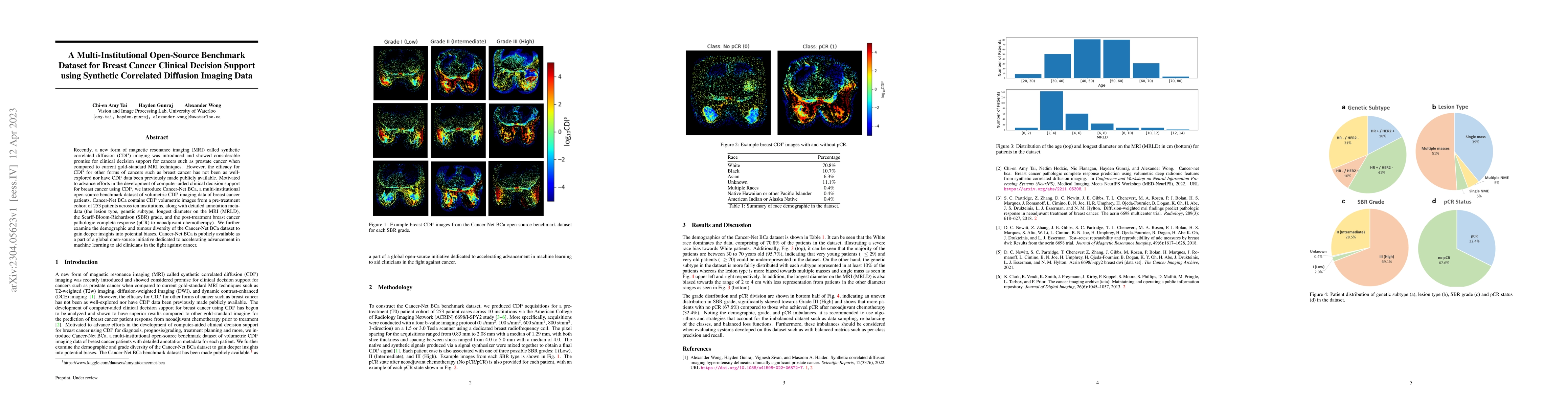 Thumbnail for A Multi-Institutional Open-Source Benchmark Dataset for Breast Cancer
  Clinical Decision Support using Synthetic Correlated Diffusion Imaging Data