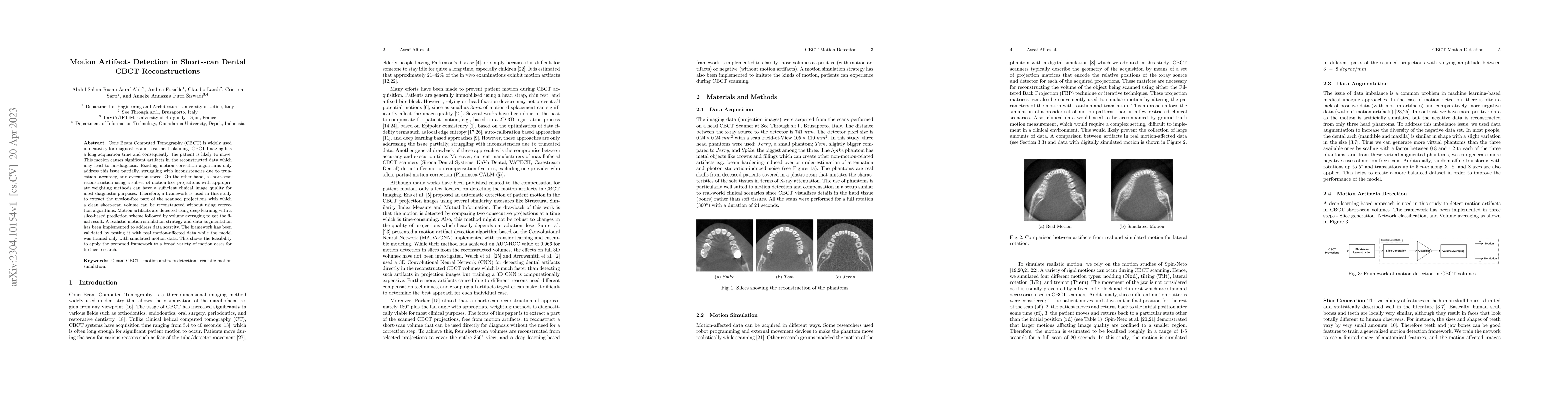 Thumbnail for Motion Artifacts Detection in Short-scan Dental CBCT Reconstructions