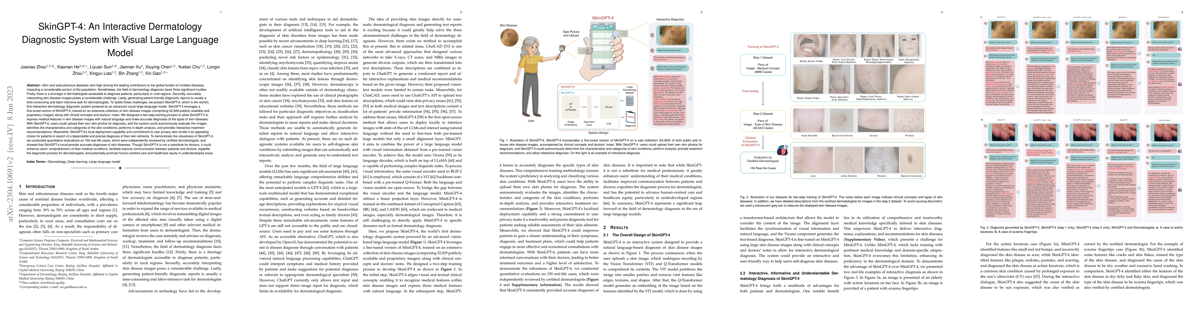 Thumbnail for SkinGPT-4: An Interactive Dermatology Diagnostic System with Visual
  Large Language Model