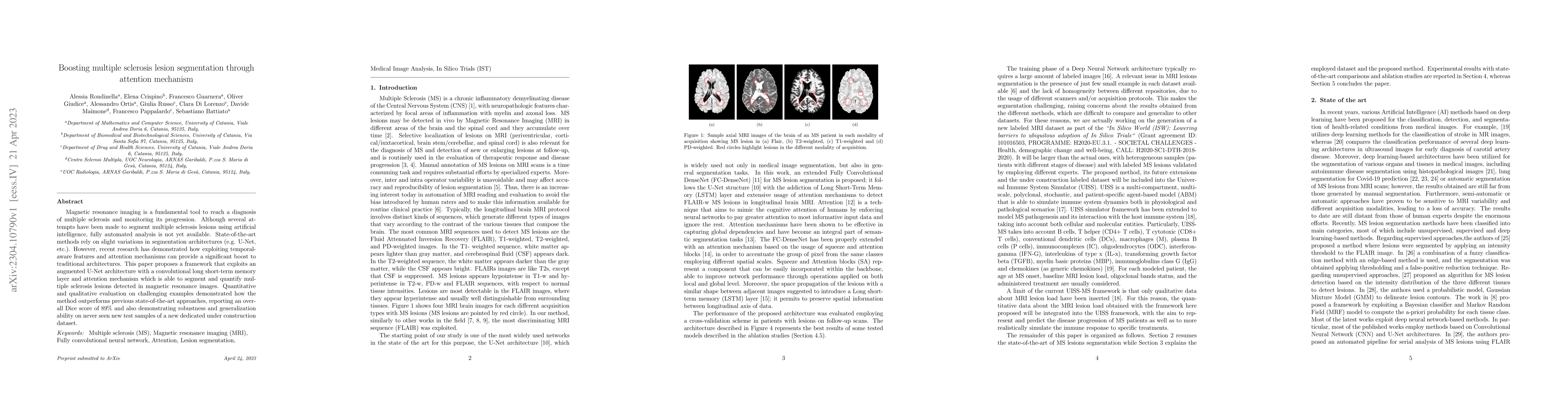 Thumbnail for Boosting multiple sclerosis lesion segmentation through attention
  mechanism