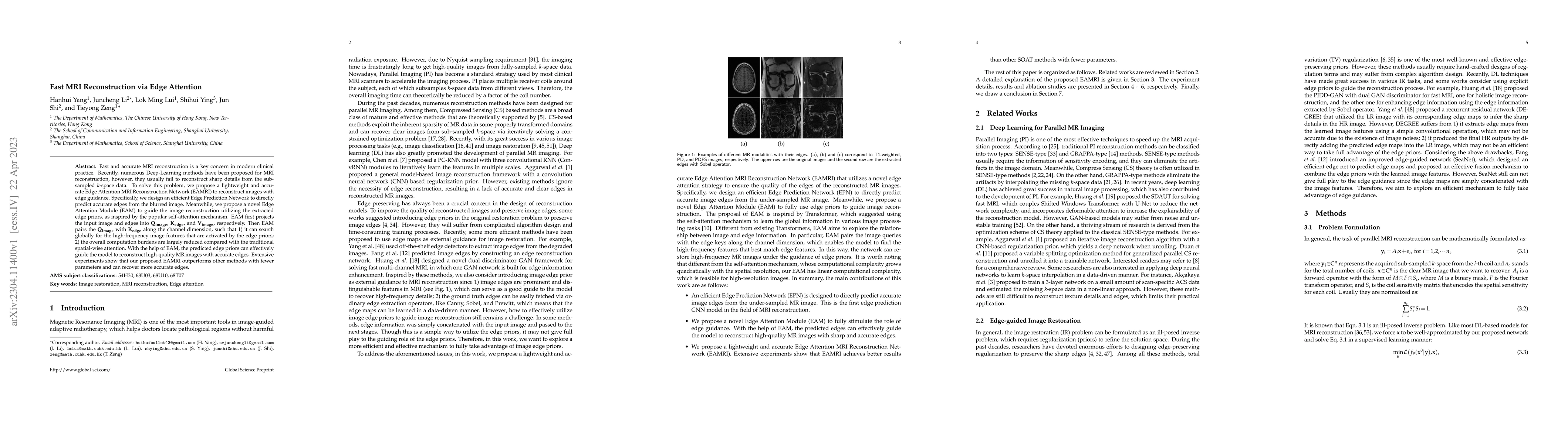 Thumbnail for Fast MRI Reconstruction via Edge Attention