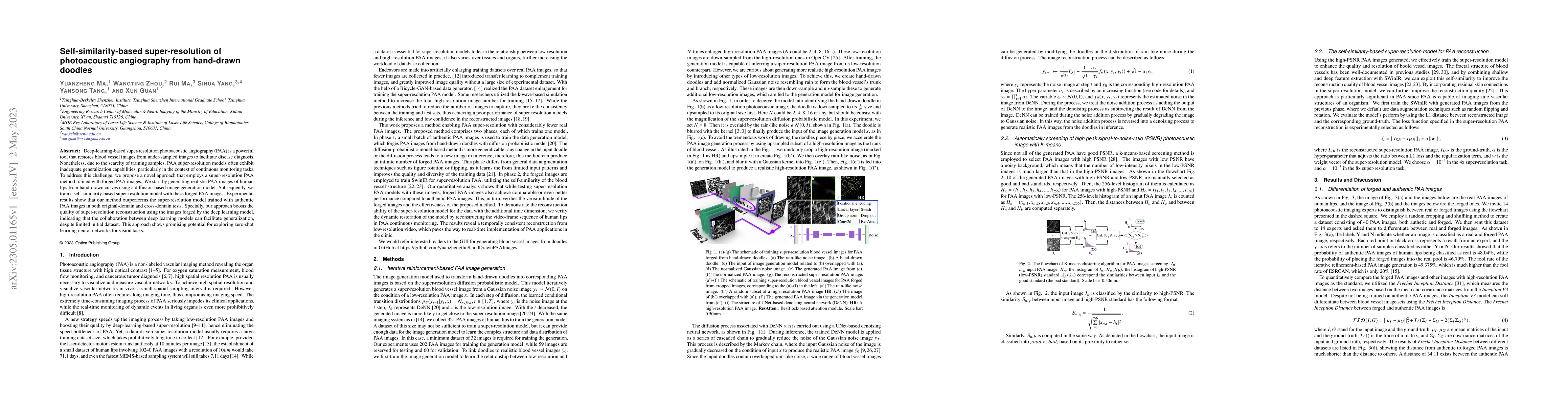 Thumbnail for Self-similarity-based super-resolution of photoacoustic angiography from
  hand-drawn doodles