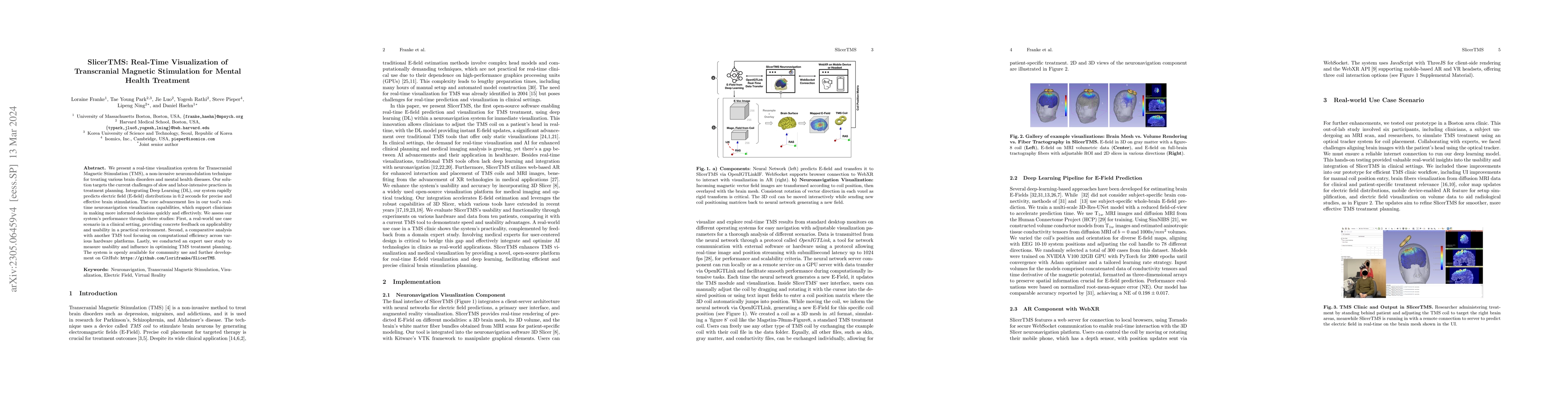 Thumbnail for SlicerTMS: Real-Time Visualization of Transcranial Magnetic Stimulation
  for Mental Health Treatment