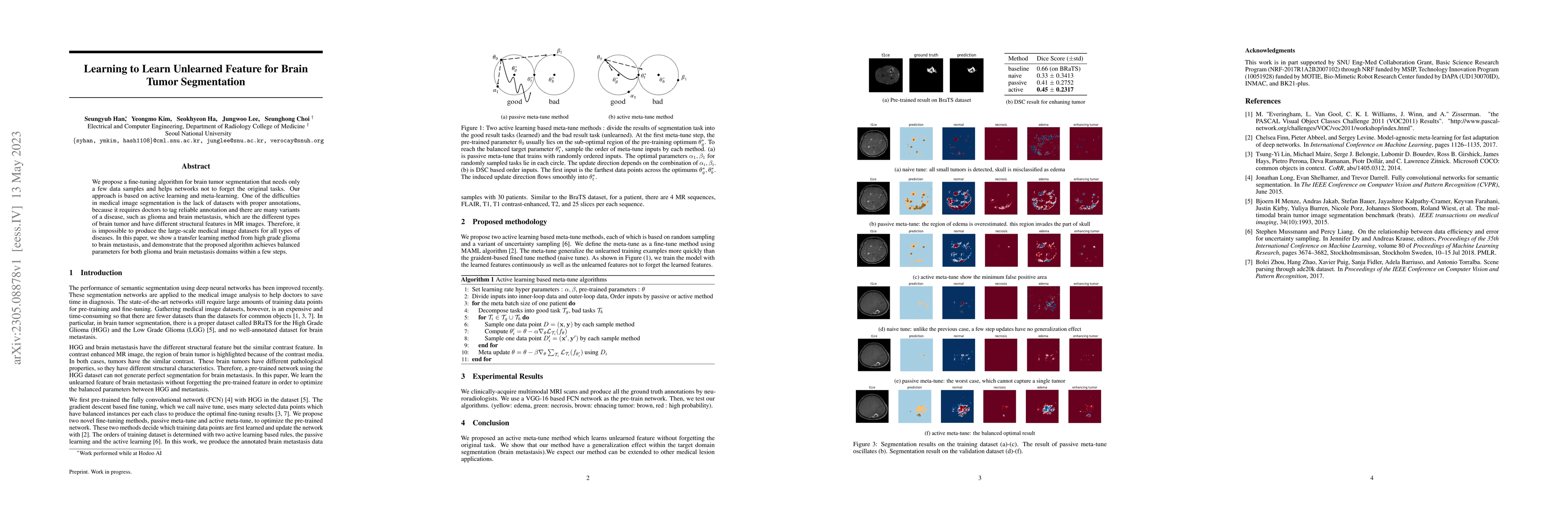 Thumbnail for Learning to Learn Unlearned Feature for Brain Tumor Segmentation