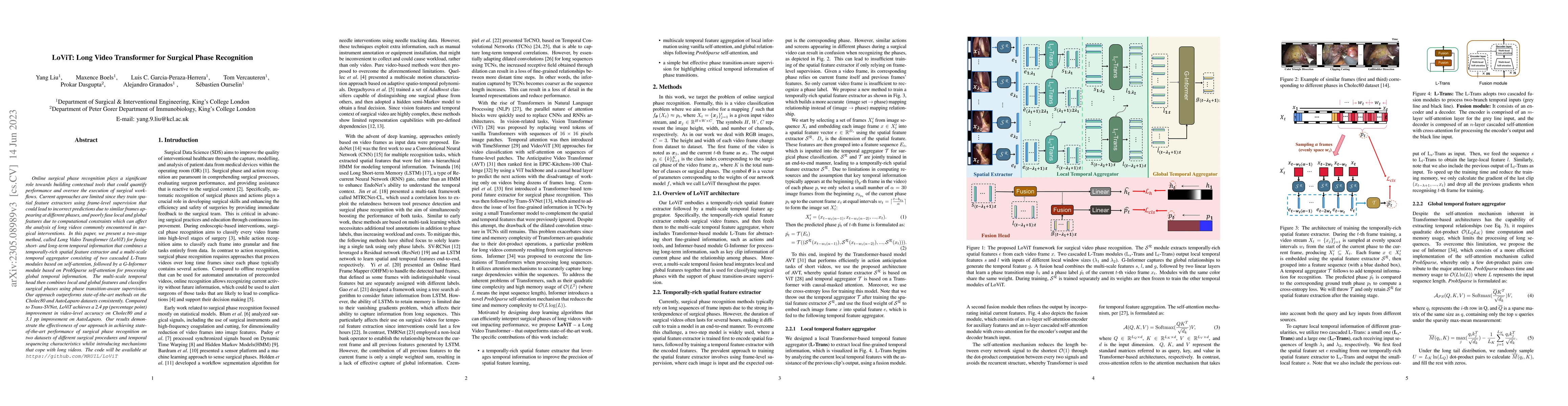 Thumbnail for LoViT: Long Video Transformer for Surgical Phase Recognition